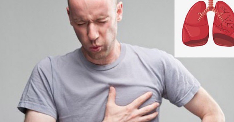 Triệu chứng đau ngực trong giai đoạn toàn phát của người nhiễm lao màng phổi